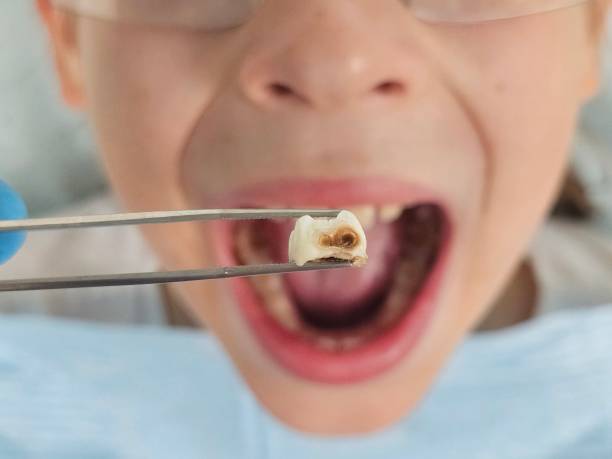 Best Emergency Pediatric Dental Care in Flora, AL